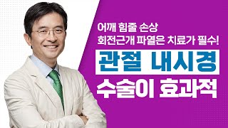 [서울성모병원] 어깨 힘줄 손상, 회전근개 파열은 치료가 필수! '관절 내시경' 수술이 효과적 - 정형외과 김양수 교수