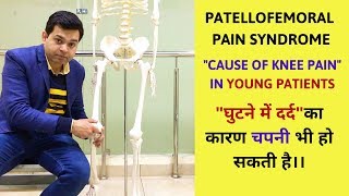 Patellofemoral Pain Syndrome, Chondromalacia patella- Cause of Knee Pain in Young Patients- PART-1