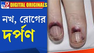 Nail Psoriasis Treatment: নখ, রোগের দর্পণ