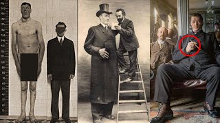 ADAM RAINER - Giant and Dwarf in the same Body! This could be one in a billion.