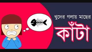 গলায় মাছের কাটা আটকে গেলে ৬টি উপায় অনুসরণ করুন! ১০০% কাটা চলে যাবে