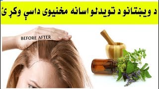 د ویښتانو د تویدلو د مخنیوي لپاره کورنی درمل