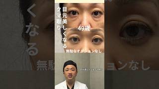 アエルクリニックのクマ取り「目元美しくなるクマ取り」 #目の下のクマ取り #クマ取り#美容整形