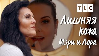 Мэри и Лора | Лишняя кожа | TLC