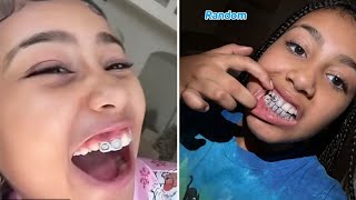 North West, 10, shows off her sparkling grill on TikTok... amid Kanye West's sho
