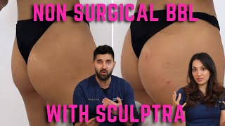 Non Surgical BBL with Sculptra | Natural Brazilian Butt Lift | Volume | Hips Dips | Cellulite