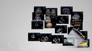 Premium portable ultrasound system- M9 has all you needed