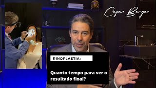 Qual o prazo para o resultado final da rinoplastia?