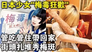 日本“梅毒狂歡”！管吃管住就能帶回家的神待少女，為什麼正在街頭扎堆秀“梅斑”？