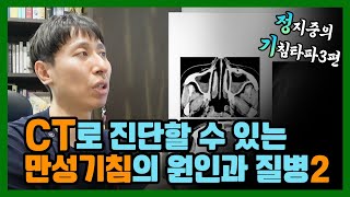 [기침타파 3편] 기침 안 멈출 때, CT로 봐야하는 기침의 원인은??