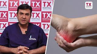 Most Common Cause Of Heel Pain | Best Orthopedic Doctor in Hyderabad | Dr Karan Patel | TX Hospitals