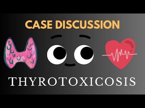 Case Discussion Thyrotoxicosis Youtube