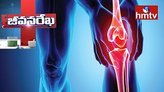 Dr.RaviKumar about Osteoarthritis Treatment || Homeocare International || Jeevana Rekha |  hmtv