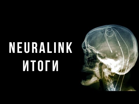 Чтение мыслей, стимуляция и управление мозгом [Neuralink]