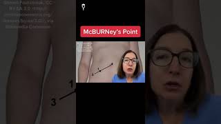 McBurney's point: Medical-Surgical SHORT |