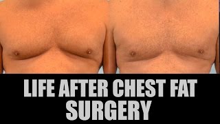 Life after chest fat/gyno surgery