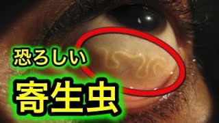 【閲覧注意】身の毛もよだつ！地球上で最も恐ろしい寄生虫 TOP10。嘘のように見えて実は本当に存在する【World ランキング】