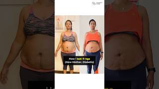 11 kgs Belly Fat loss with Homemade Diet (New Mother, Diastasis Recti case)