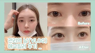 관리의 날 [VLOG] : 애교필러 후기 | 통증 | 필러 종류 | 유지 기간 | 부작용 | 리터치  [MakeUp] : 메이크업픽서 추천 | 자트인사이트 🤖