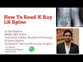 How To Read X Ray LS Spine..Dr Sai Chandra MBBS DNB (Ortho)