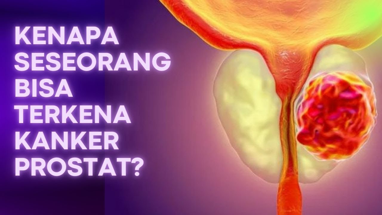 Ketahui Penyebab Dan Gejala Kanker Prostat Yang Menyerang Pria - YouTube