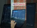 Day 22: Configuring Redux Toolkit for Large React Projects