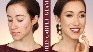 FLAWLESS DRUGSTORE MAKEUP FOR ACNE