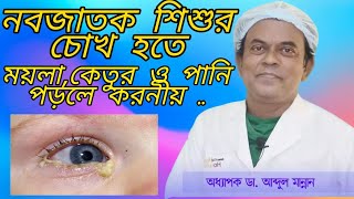 নবজাতক শিশুর চোখ হতে ময়লা, কেতুর ও পানি পড়লে করনীয় | Prof.Dr.Md Abdul Mannan| Eye Specialist‌‌..