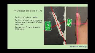 Positioning of the digits Episode 7 #LazyBonesRadiology