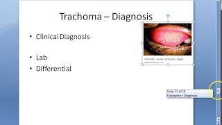 Ophthalmology 076 e Trachoma Lab Diagnosis Differential Differentiate from Viral and Vernal