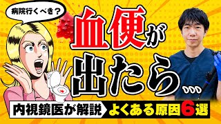 【放置厳禁】便に血が‼︎精密検査は必要？　痔だと思っていたら大腸がんに　原因別に専門医が解説　教えて萱嶋先生 No313