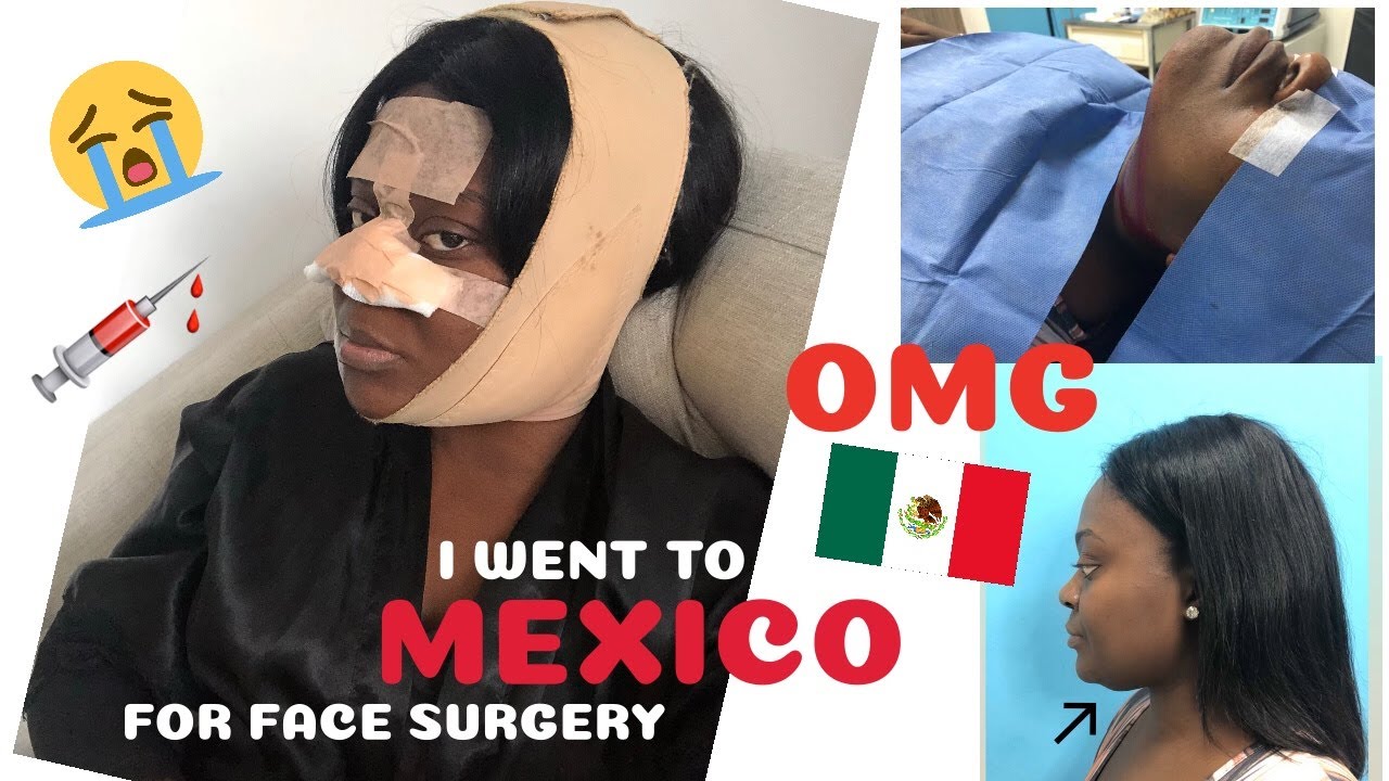 I M Back I Got Face Surgery In Mexico Recovery Jeneevalove Youtube