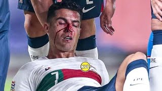 Cristiano Ronaldo Injury vs Czech Republic|Portugal vs Czech Republic|HD|2022