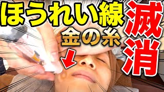 【整形級　刺さない金の糸】刺さない糸リフト　もはや鍼いらず？衝撃触れずに金の糸入れたらほうれい線・首のシワが消えた【鍼】