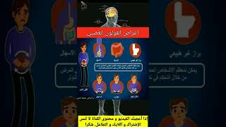 أعراض و علامات القولون العصبي