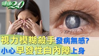 視力模糊殺手發病無感！小心早發性白內障上身 健康2.0