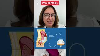 Paracentesis: Medical Surgical SHORT | @LevelUpRN