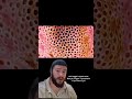 don’t watch this if you have trypophobia disturbing