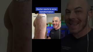 Doctor reacts to crazy acne transformation! #acne #dermreacts #accutane