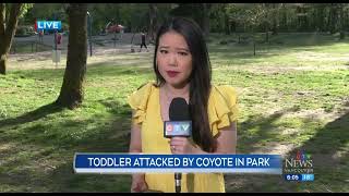 Toddler attacked by coyote in Port Coquitlam, B.C.