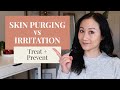 Skin Purging vs. Irritation | Dermatologist Guide