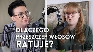 Dlaczego przeszczep włosów ratuje? [Przeszczep włosów w Turcji]