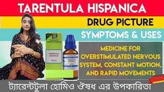 Tarentula Hispanica Homeopathic Medicine Explain? Tarentula Hispana 30, Tarentula Hispanica 200