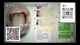 长条舌 奇效舌诊 2023年 李芳祥 倾力奉献 Lee Fangxiang tongue diagnosis