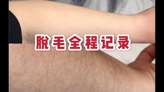 多毛星人的救赎！！白了三个度？？皮肤变细腻了？？ | 我的脱毛仪实测记录