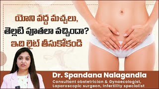 యోని భాగంలో తెల్ల మచ్చలు | Symptoms of Lichen Sclerosus in Women | Sreshta Multispeciality Hospitals