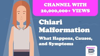 Chiari Malformation - What Happens, Causes, and Symptoms