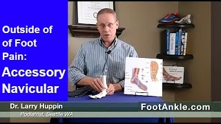 Accessory Navicular – Extra Bone on Inside of Foot | Seattle Podiatrist