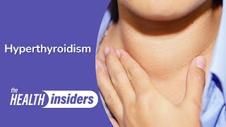 Treating Hyperthyroidism