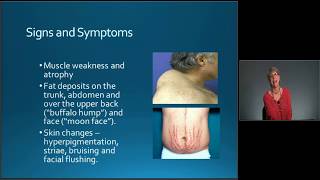 Medical-Surgical Nursing Exam Review: Endocrine Disorders - MED-ED
